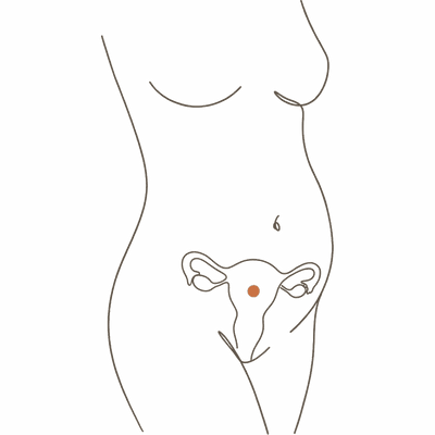 Line drawing of a woman's torso at 14 weeks pregnant, showing the uterus halfway to the navel and a small early bump