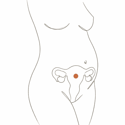 Line drawing of a woman's torso at 17 weeks pregnant, showing the uterus risen toward the navel with a clear bump
