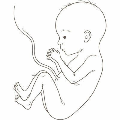 Line drawing of a 24-week foetus with thin limbs and wrinkled, see-through skin