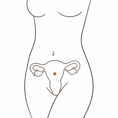 Line drawing of a woman's torso at 24 weeks pregnant, showing the enlarged uterus and a rounded bump