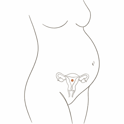 Line drawing of a woman's torso at 25 weeks pregnant, showing the uterus inside a full rounded bump