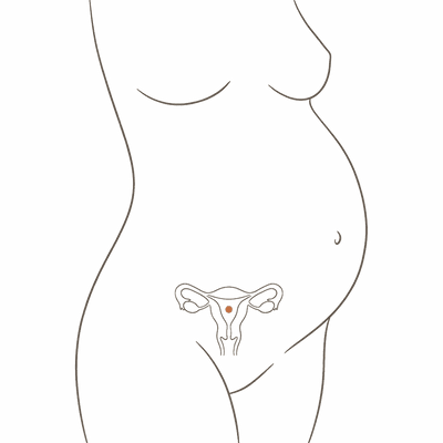 Line drawing of a woman's torso at 26 weeks pregnant, showing the uterus inside a full rounded bump