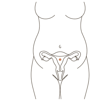 Line drawing of a woman's torso at 32 weeks pregnant, showing the uterus inside a high rounded third-trimester bump