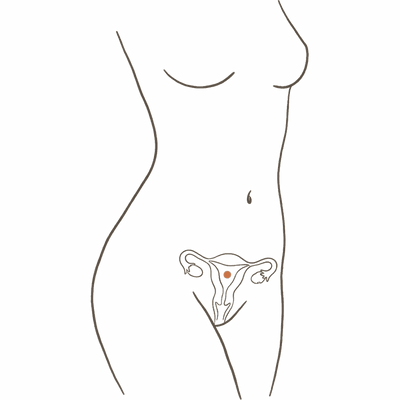 Line drawing of a woman's torso at 9 weeks pregnant, showing the enlarged uterus still low in the pelvis and a flat abdomen